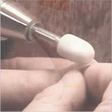 使用纯羊毛抛光头进行抛光义眼片表面,使得眼片更加光滑。